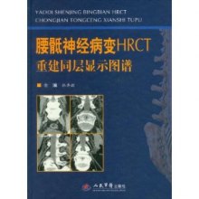 《腰骶神经病变HRCT重建同层显示图谱》,97