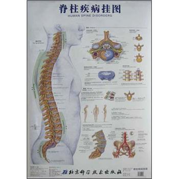 脊柱疾病挂图(新版)